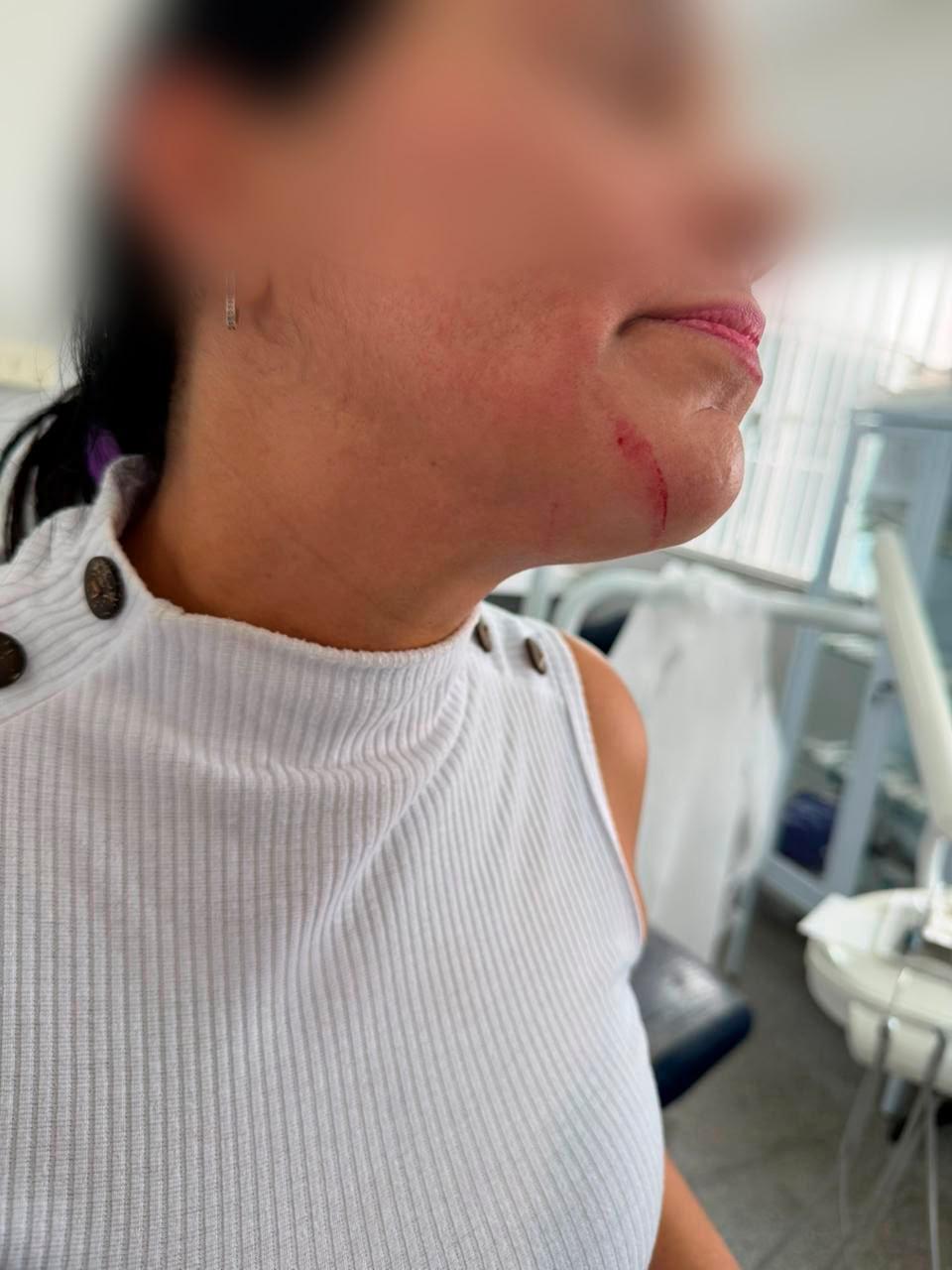Secretaria de Saúde repudia agressões contra auxiliar de saúde bucal 